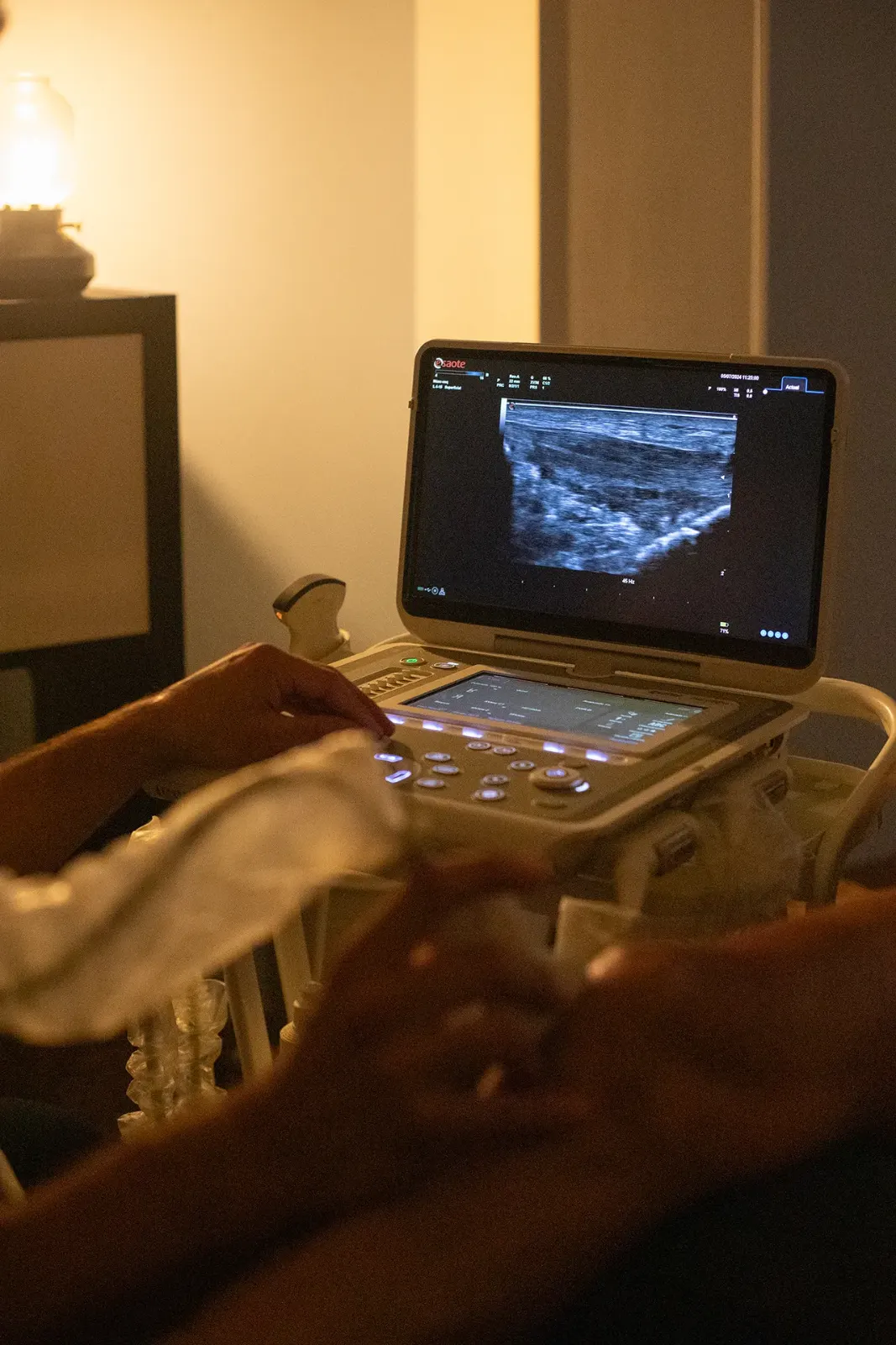 Imagen de ecografía musculoesquelética durante una valoración clínica
